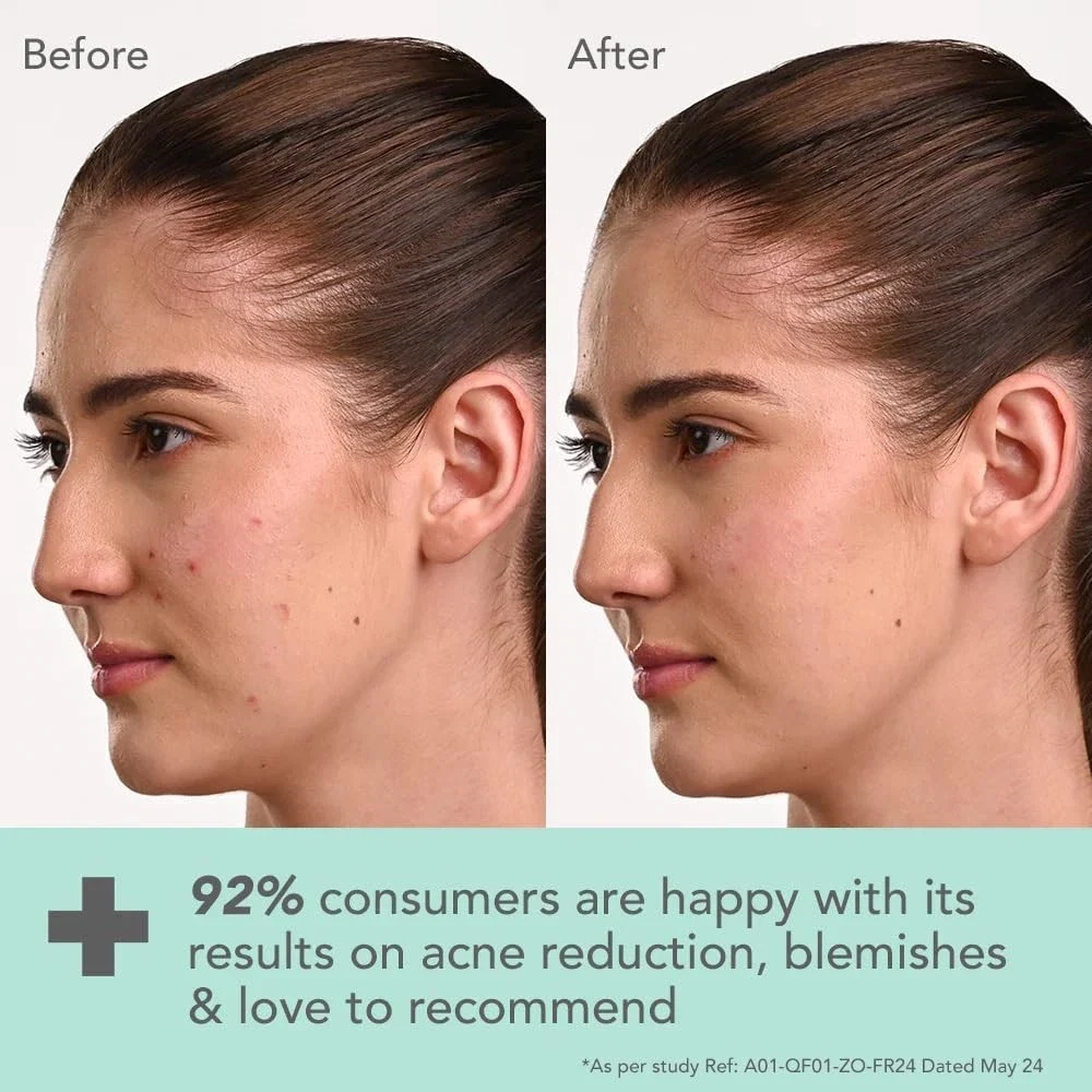 Lotus Herbals Dermabotanics Kojic Acid + Multi Berry Blemish Free Face Wash 100g thumbnail