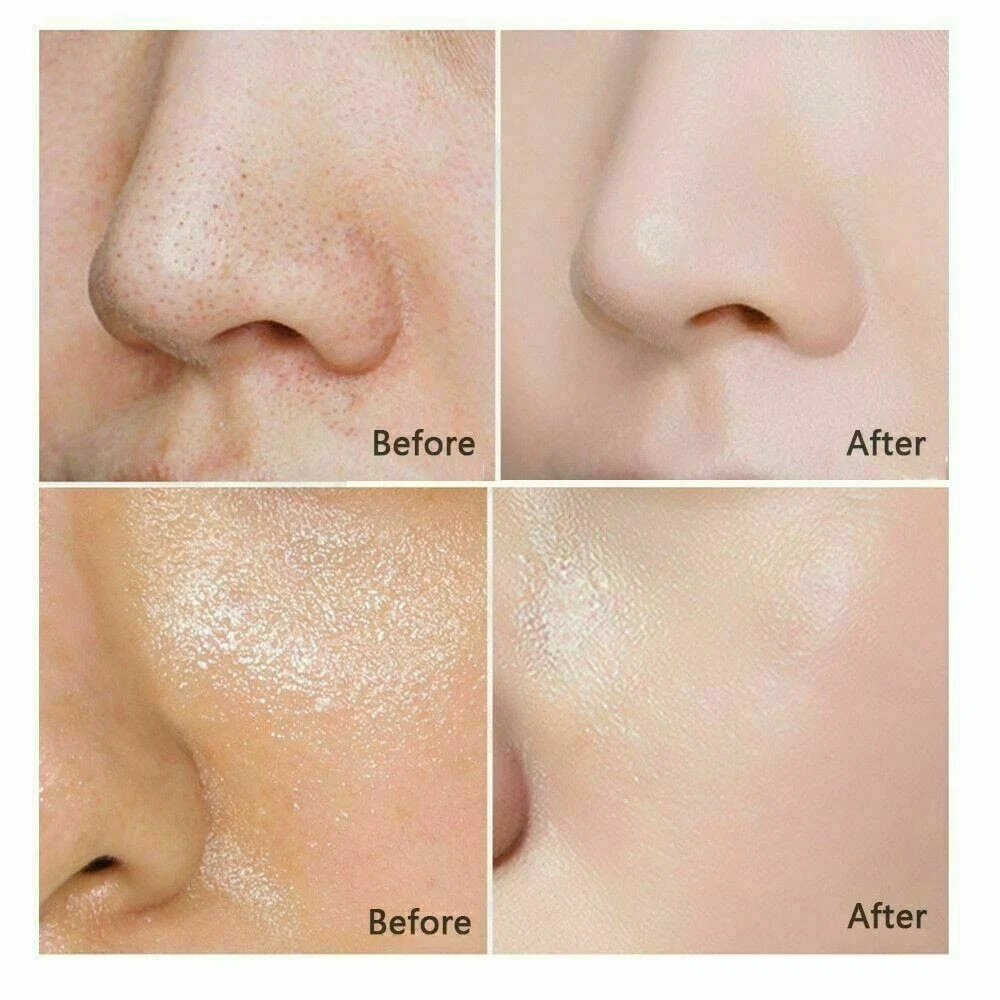 Thai Rice Milk Handmade Herbal Soap Whitening Collagen Acne Body Face 12 Soaps thumbnail