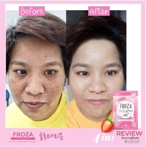 Froza Gluta Pure 4in1 Anti- Aging and Whitening Dietary Supplement 60 Capsules thumbnail