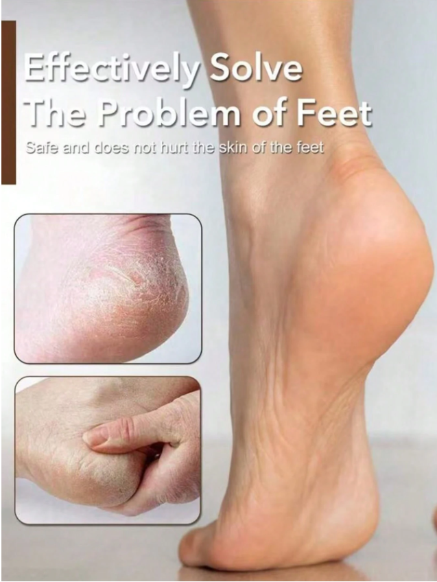 Foot File Callus Remover Stainless Steel Pedicure Rasp Scrubber Tool 1pcs thumbnail