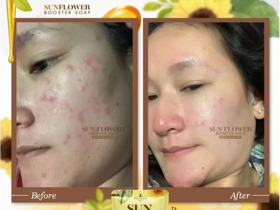 Sun Flower Booster Soap By Precious Skin Thailand Highly Moisturizing 80g thumbnail